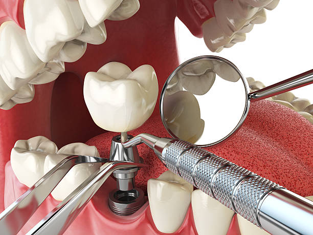 Best After-Hours Dental Trauma Care in Cypress, CA